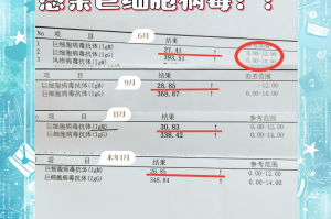 「上海多数病例在管控中发现」〃上海病毒多少例