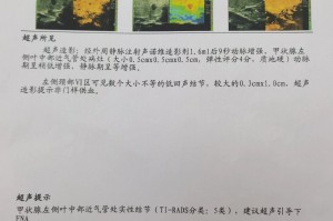 【西安确诊病例最新情况/西安确诊病例最新消息】