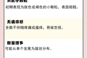 【杭州新增无症状1例/杭州新增一例无症状感染者在哪个区】