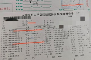 「黑龙江新增本土确诊43例」〃黑龙江新增确诊病例37例