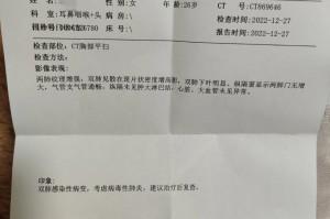 西安确诊新型肺炎︰(西安确诊新型肺炎病例)