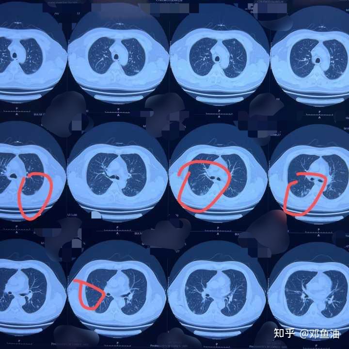美国新型冠状病毒最新消息.美国新型冠肺炎最新消息-第2张图片