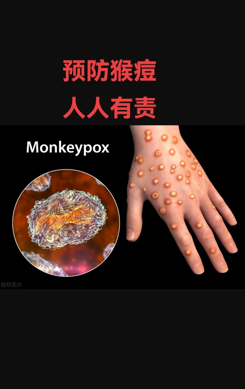美国疫情2020〃美国疫情2025-第2张图片
